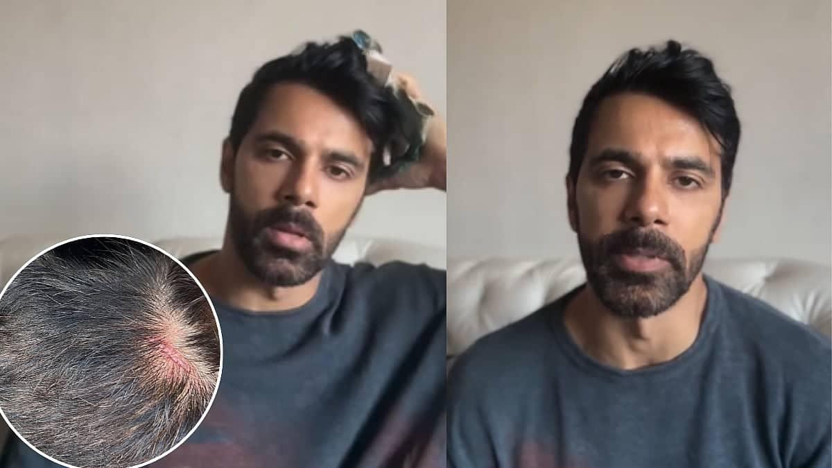 Anuj Sachdeva Calls Out Mumbai Police: Where's the Justice?