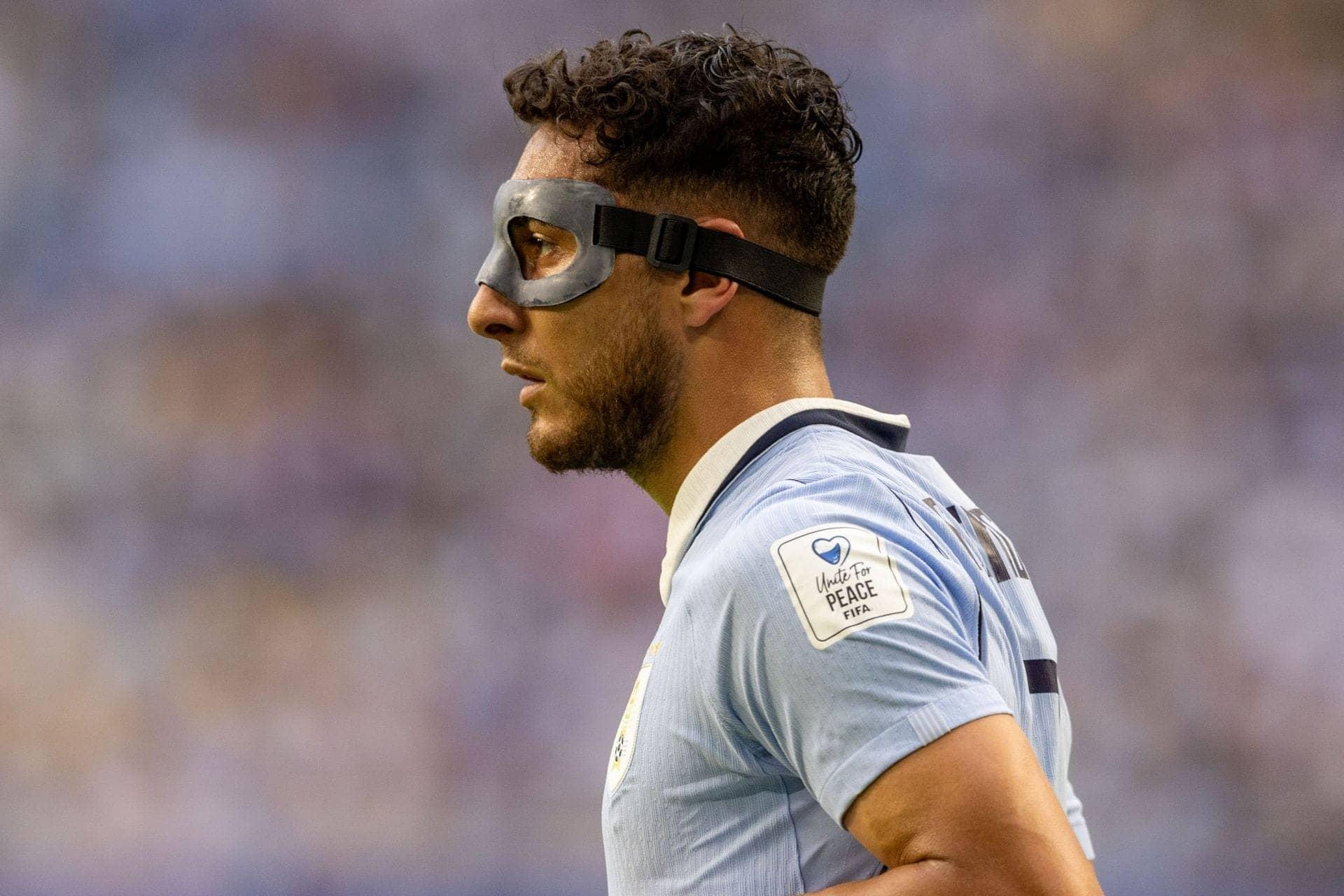 Sebastian Caceres Ka Face Mask: Kya Hai Yeh Naya Trend?